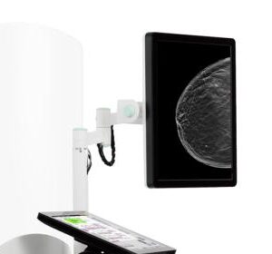 https://www.femmevitahealthcare.com/wp-content/uploads/2024/03/Hologic-Clarity-HDTM-High-Resolution-3DTM-Imaging-Technology_540x480-300x280.jpg