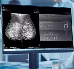 https://www.femmevitahealthcare.com/wp-content/uploads/2024/03/Hologic_Quantra_2.2_Breast_Density_Assessment_Software_Thumbnail-300x280.jpg