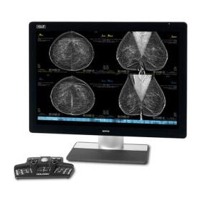 https://www.femmevitahealthcare.com/wp-content/uploads/2024/03/Hologic_SecurView_Workstations_Thumbnail-300x280.jpg